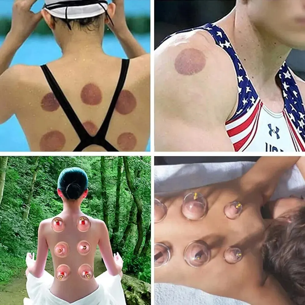 Biomagnetic Chinese Cupping Therapy Set Massage Meridian Therapy Acupuncture Anti Cellulite Suction Cup Body Massage Cans 1 Set