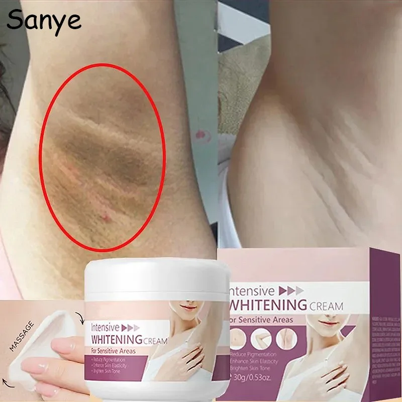 Brighten Cream For Dark Skin Bleaching Armpit Elbow Lightening Cream Intimate Area Woman Moisturizer Korean Skin Care Emulsion whitening lotion