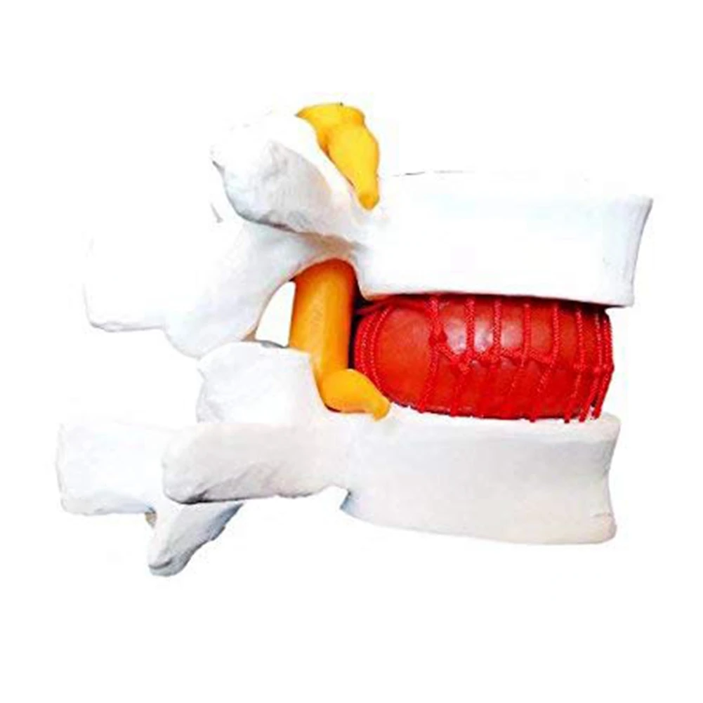 

Анатомический позвоночник, дегенеративный Поясничный человеческий позвоночник, модель 1 шт.