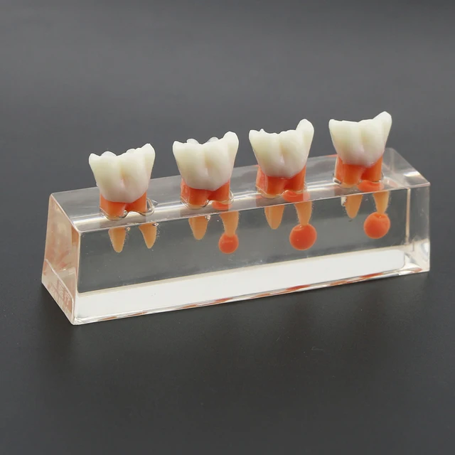 Bande Universali Per Otturazioni Bande Matrice Dentali Sezionali, Anello E Morsetto Per Sistema Palodent V3 - Per Odontoiatria Materiale Odontotecnico - Foto 14