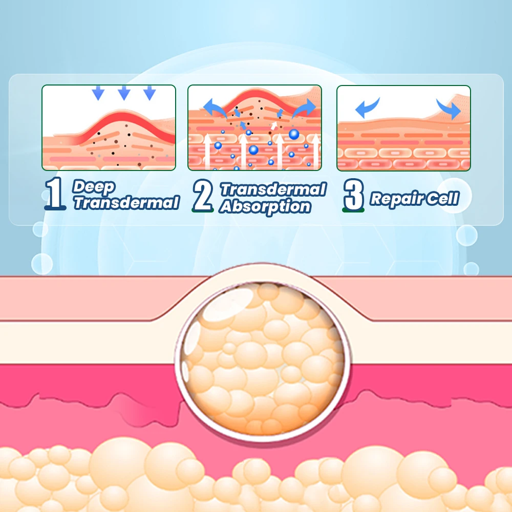 8/40/80Pcs Sumifun Lipoma Removal Patch Anti Skin Tumor Swelling Fat Lump Nodular Reduce Inflammation Subcutaneous Mass Plaster pain relief patch