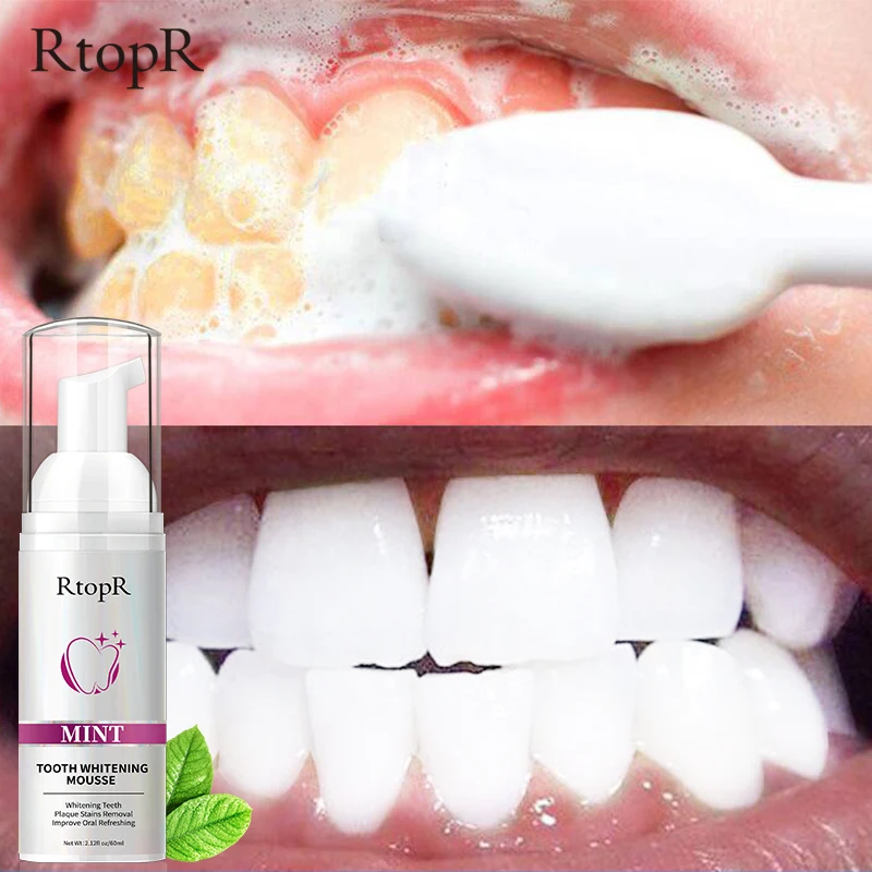 Rtopr Teeth Cleansing Whitening Mousse Removes Stains Teeth Whitening Oral Hygiene Mousse Toothpaste Whitening And Staining 60ml - Toothpaste - AliExpress