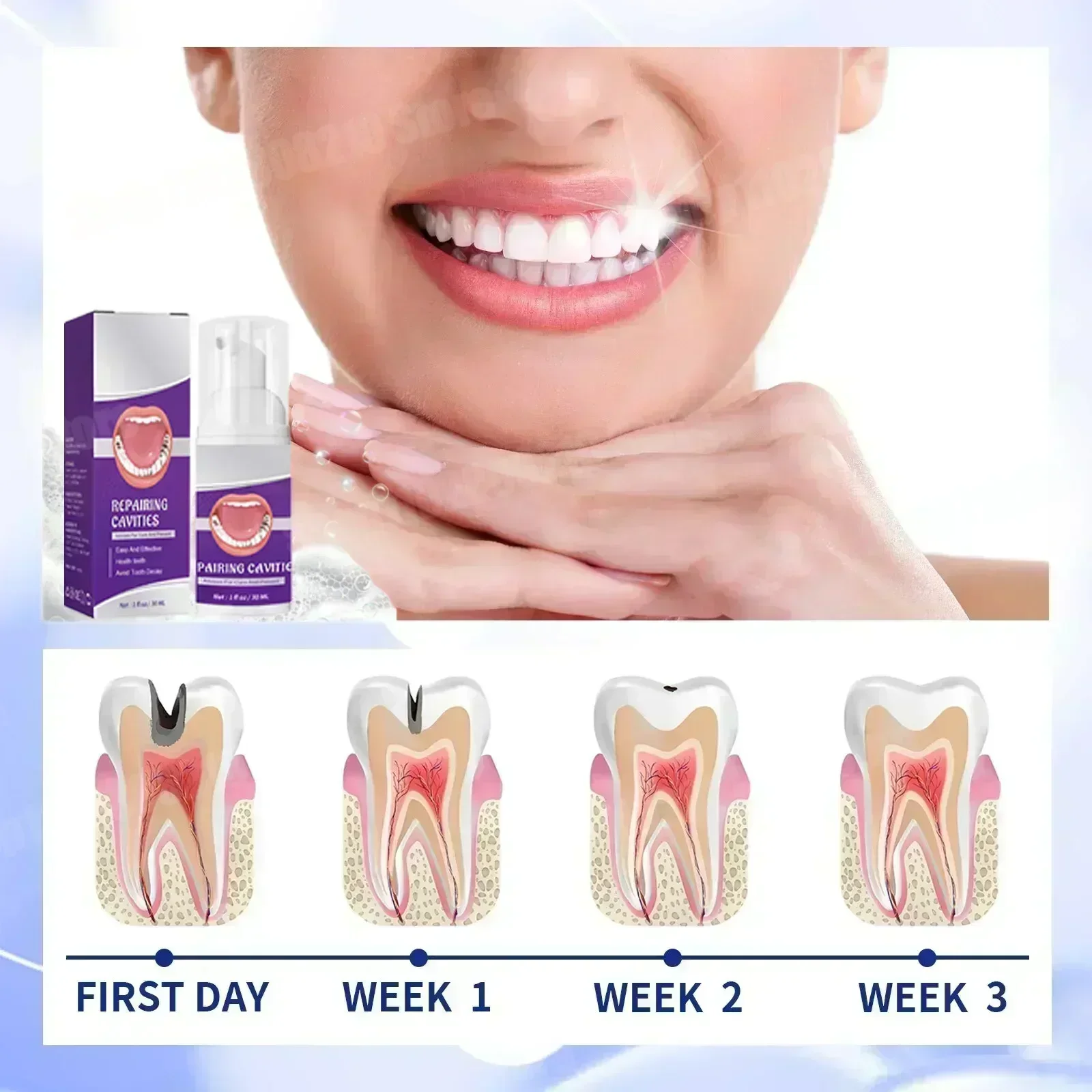 Tooth decay repair all tooth decay cavities protect teeth Colour Correcting