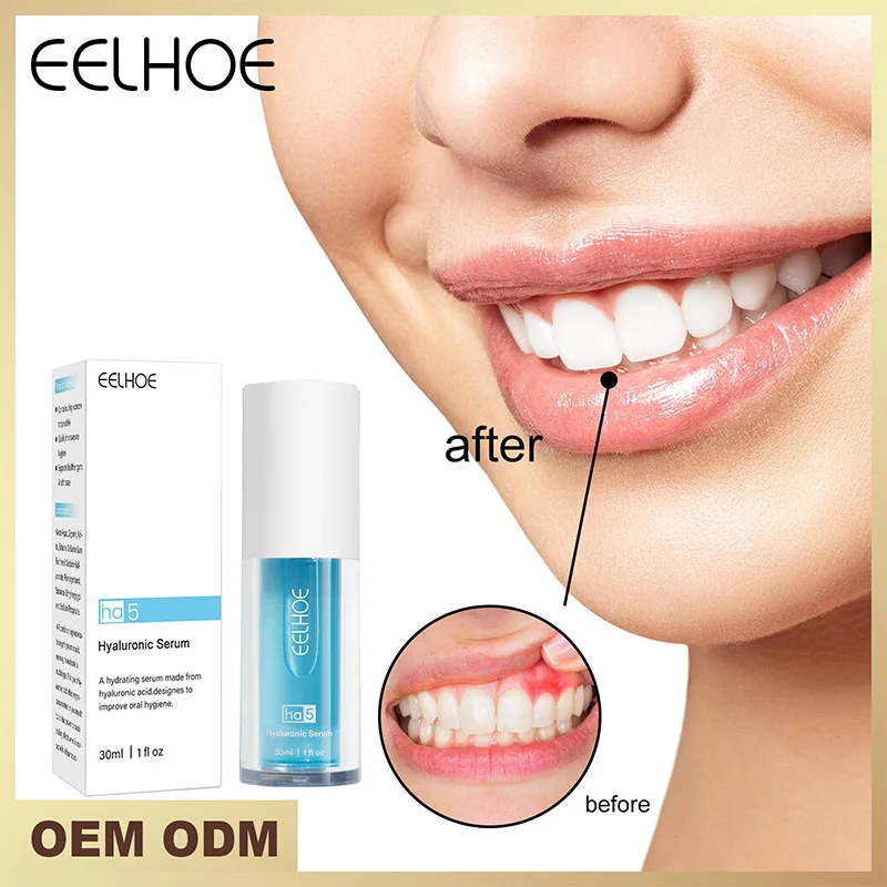 

30G Sodium Hyaluronate Toothpaste Teeth Cleaning Gum Care Fresh Breath Anticavity Solid Teeth Whitening Toothpaste Tooth Care