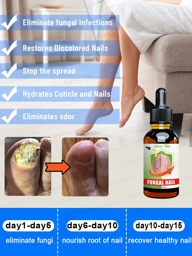 Fungal Nail Repair Fast OnychomycosisFungus Nails