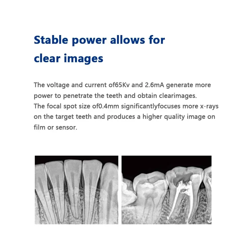جهاز أشعة سينية رقمي عالي التردد
