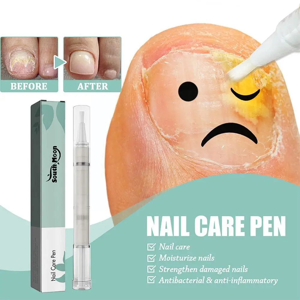 Anti Fungal Nail Pen Dispel Leuconychia Liquid Remove Onychomycosis Tools Repair Nail Serum Pen Care Fungus