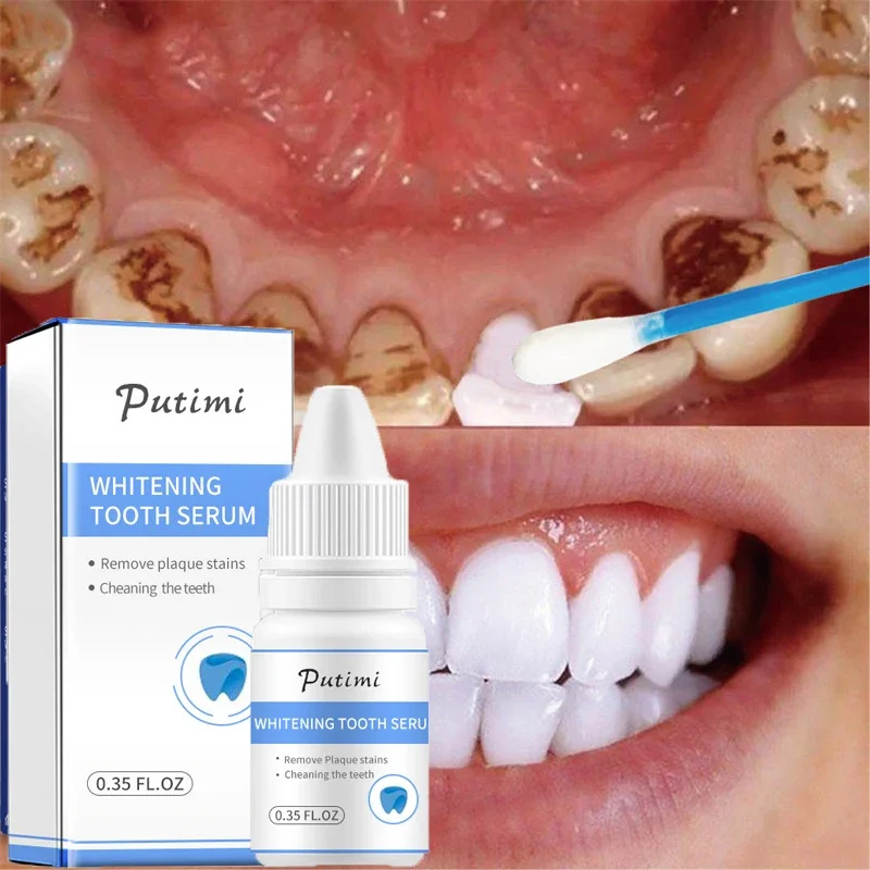 

Teeth Whitening Essence Bright Remove Dental Plaque Stains Bleach Whitener Cleaning Mouth Fresh Breath Oral Hygiene Care Tools