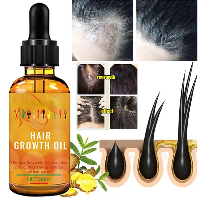 Ginger Hair Growth Serum Essential Oil Anti Hair Loss Fast Grow Hair
