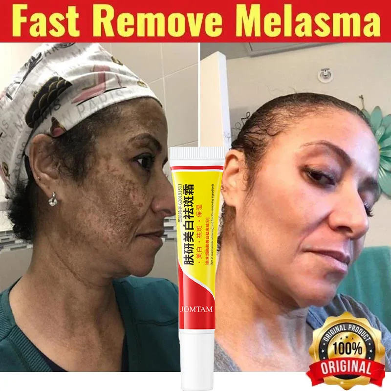 Face Brightening Cream Niacinamide Reduce Melasma Melanin Lighten Dark Skin Chloasma Serum Weaken Fine Lines Care niacinamide serum whitening body cream