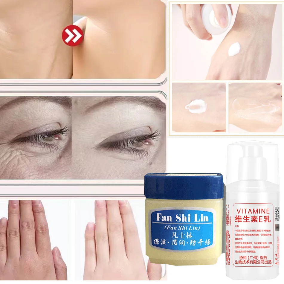 Body Tightening Cream 100ml Vitamin E Body Lotion Body Moisturizing Fragrance Lightening Cream Whitening Emulsion Itching And 45g Foot And Hand Cream