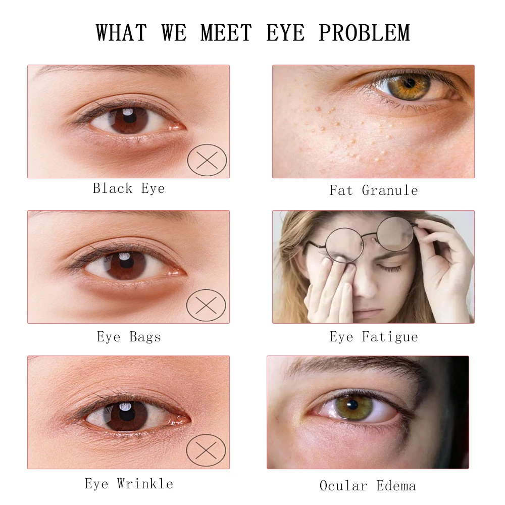 Mini Hifu Beauty Machine BB Eyes Face Lifting Tightening Device Usuwanie Zmarszczek Ciemne Worki EMS Eye Massager Salon Urody_voghion.com