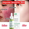 7 Day Repair Redness Serum Sooth Itching Sensitive Skin Improve Rosacea Shrink Pore Smooth Nourish Facial Skin Korean Cosmetics 1