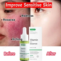7 Day Repair Redness Serum Sooth Itching Sensitive Skin Improve Rosacea Shrink Pore Smooth Nourish Facial Skin Korean Cosmetics 1