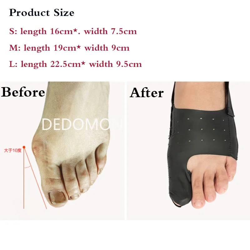 Correttore Piede Flanella Plastica Correttore Alluce Valgo JHTSOLE - Stecche Raddrizzanti 2 Pezzi Per Piede Puntali Per Stecca - Foto 3