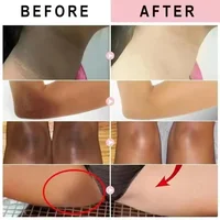 Crème éclaircissante pour éliminer la mélanine et la Nicotinamide, pour la peau foncée, efficace, éclaircit les parties intimes de l'eau intérieure des cuisses 2