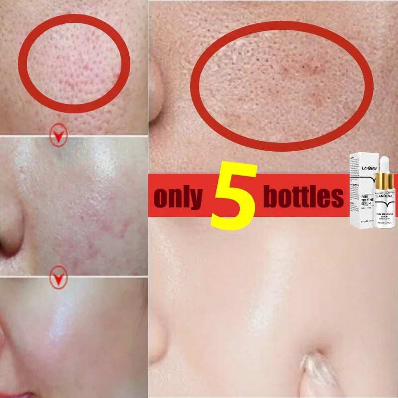 Acid Pore Shrink Face Serum Hyaluronic Acid Moisturizing Nourish Smooth Pores Repair Essence Firm Korean Skin Care Beauty