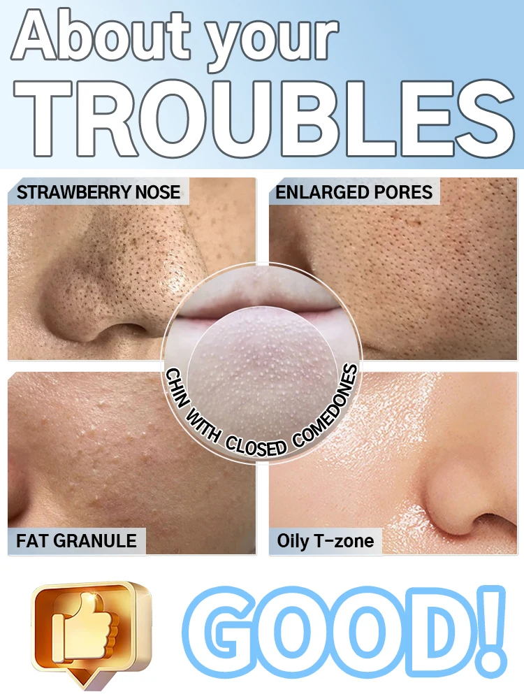 Generation-2, Removes impurities from the surface of the nose with high tech vacuum suction, say goodbye to blackheads and acne. 2