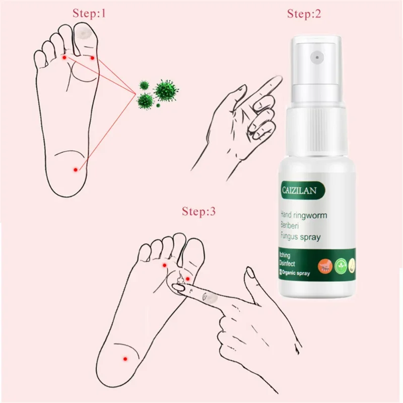 Nail Fungus Remover Pain Analgesic Cream Anti Fungal Spray Foot Fungus Cream For Cracked Heel Peeling Blister Repairing Feet