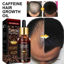 

Hair Growth Essential Oil Hair Loss Preventation Nourishing Hair Roots Hair Repair Treatment Oil Promote Hair Growth Essence
