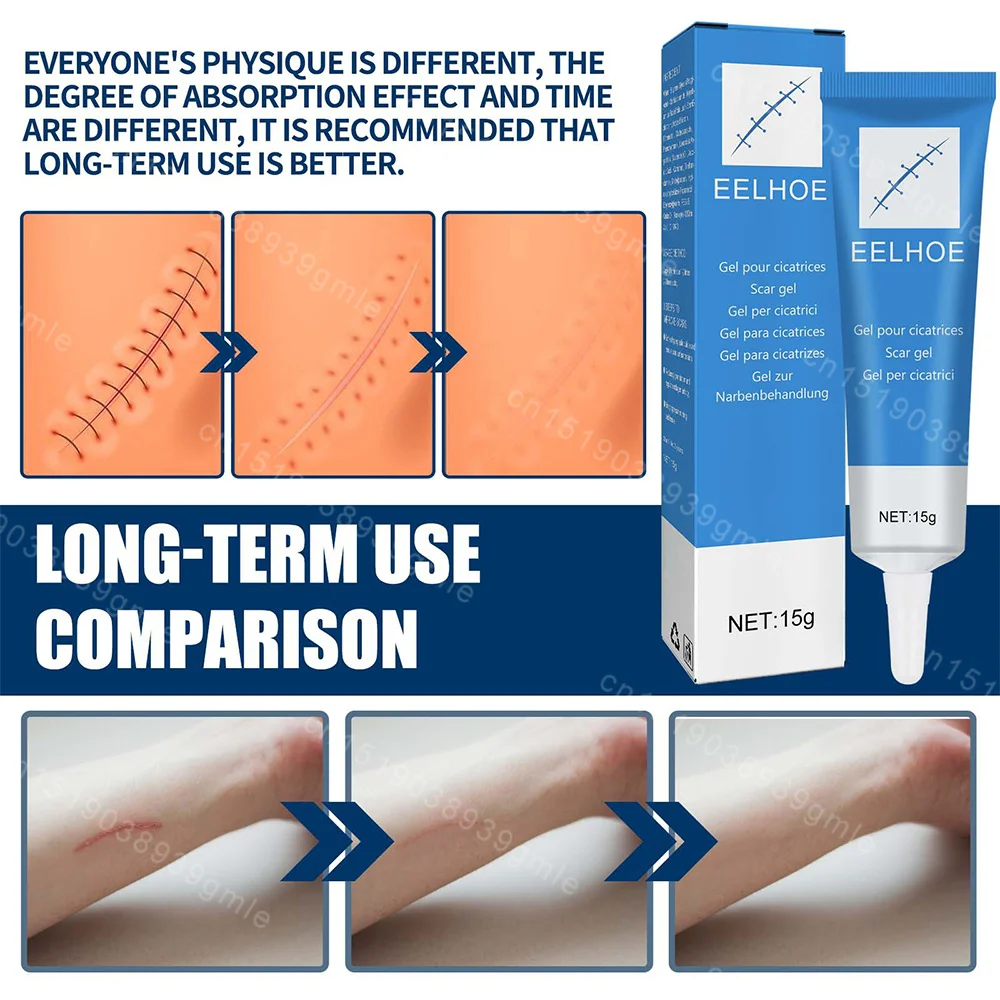 Recovery Scar Cream Fast Removal Skin Scars Treat Surgery Scars Stretch Marks Acne Pox Prints Burn Repair Facial Care Gel pain analgesic cream