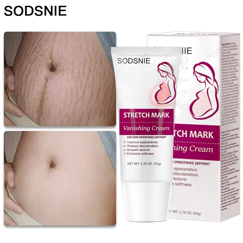 

Stretch Marks Removal Cream Maternity Skin Repair Remove Pregnancy Scars Vitamin E Anti-Aging Anti-Wrinkle Firming Body Care 50g