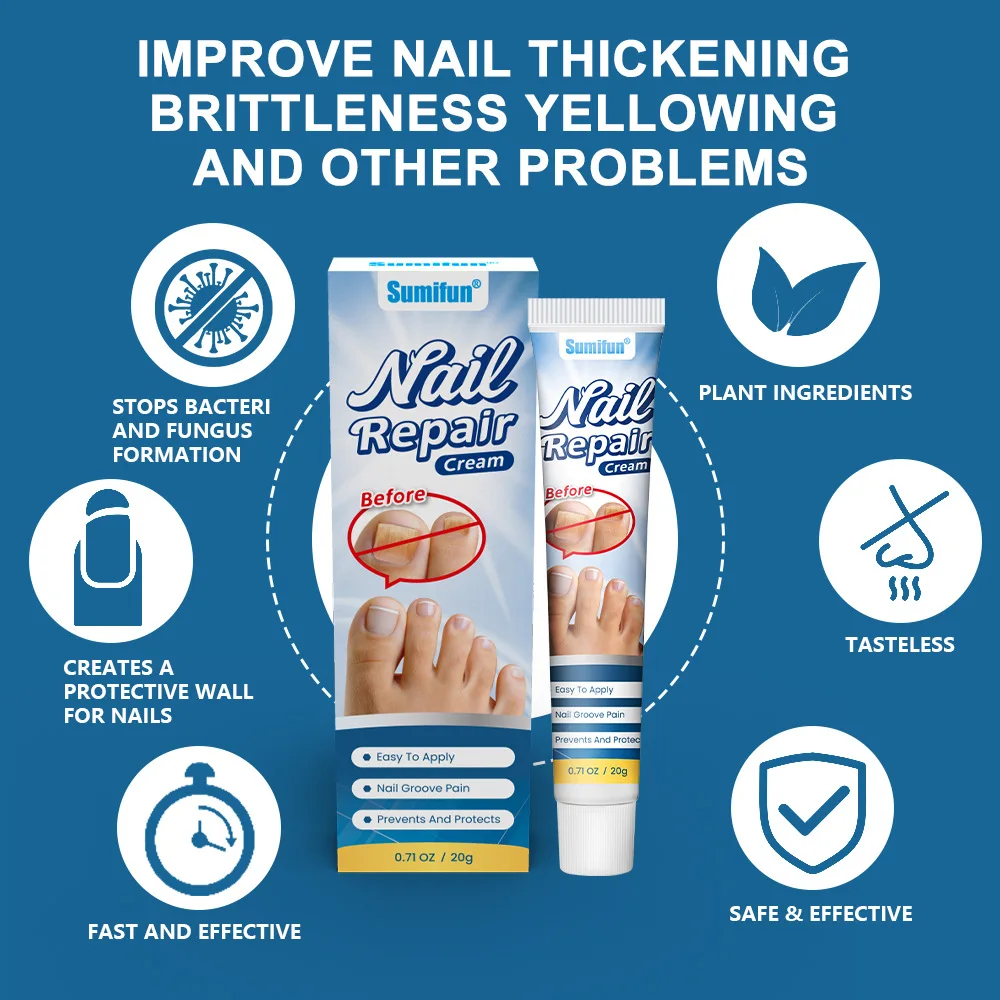 Nail Fungus Treatment Cream Foot Toe Nail Fungus Removal Serum Anti-infection Paronychia Onychomycosis Repair Gel Care U&ntilde;as