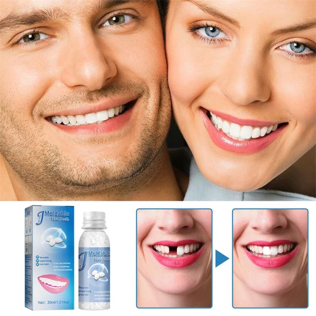 Resin False Teeth That Fit Solid Glue Temporary Tooth Repair Set Moldable  Teeth and Gap False Teeth Glue Denture Tooth Care - AliExpress