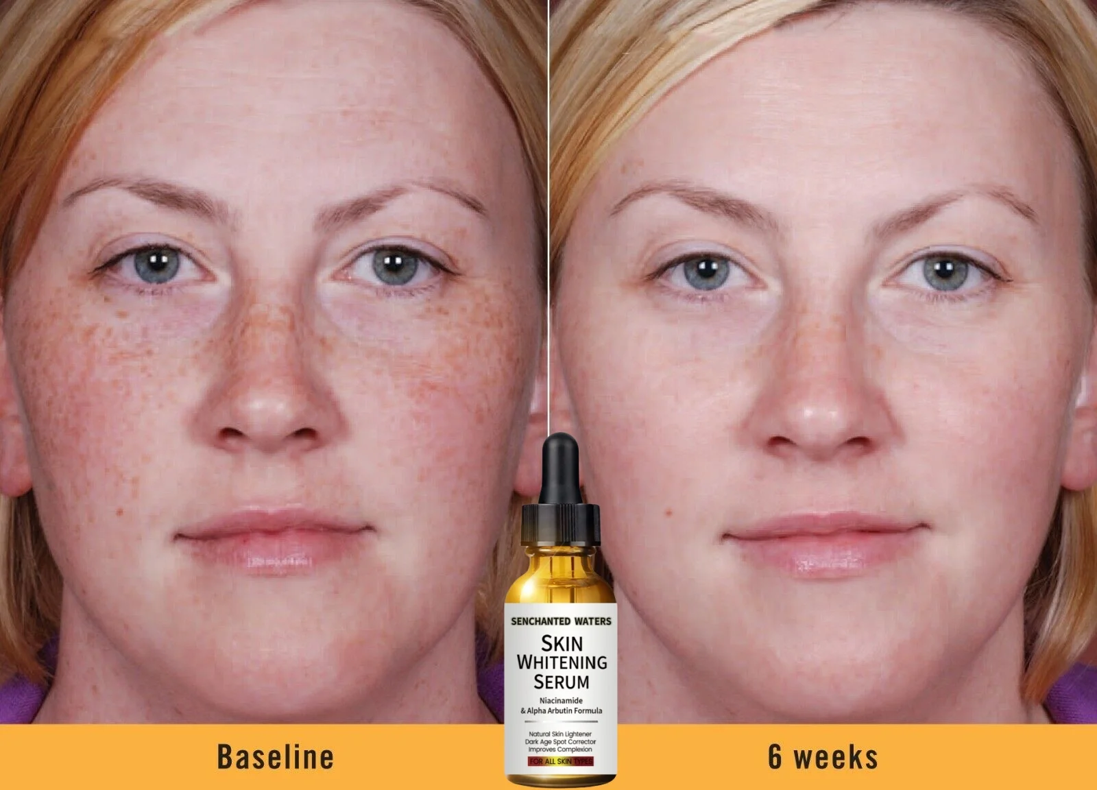 

Dark Skin Whitening Lightening Ultra Brightening Serum Dark Spot Bleaching Cream 30ML