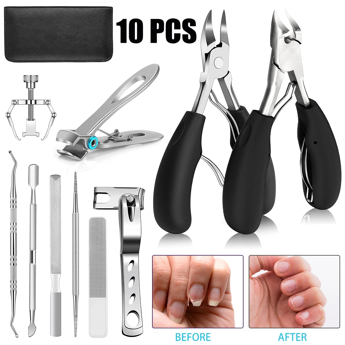 10Pcs Ingrown Toenail Clippers Kit Stainless Steel Ingrown Toenail Removal Kit Clippers Set for and Thick Nail