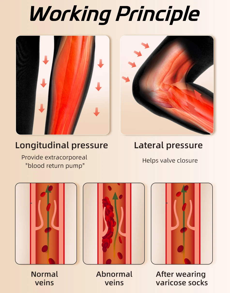 Legbeauty Medizinische Kompressionsstrümpfe, 23–32 mmHg, Damen-Oberschenkel, offene Zehen, Krampfadern, Kompressionsunterstützung, Strumpfhosen in Übergröße – Detail 7
