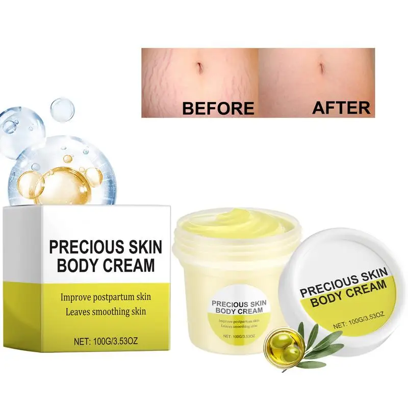 Stretch Mark Remover Cream 100g Maternity Skin Care Cream Moisturizing Smoothing Maternity Skin Care Increase