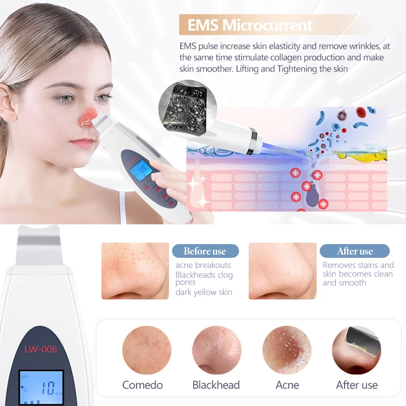 Ultrasonic Skin Deep Cleansing Machine Facial Acne Removal Facial Massage Keratin Blackhead Lifting Beauty Device