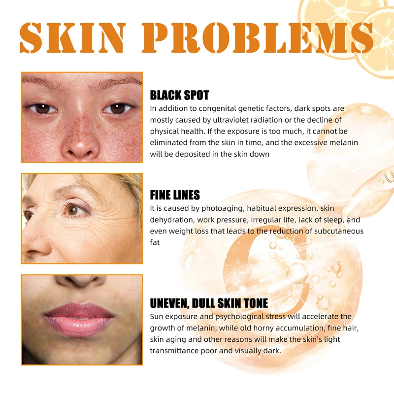 Facial Serum Vitamin C Whitening Effective Remove Dark Spots Freckles Fade Melanin Anti-Wrinkle Brightening Nourishing Face Skin Care