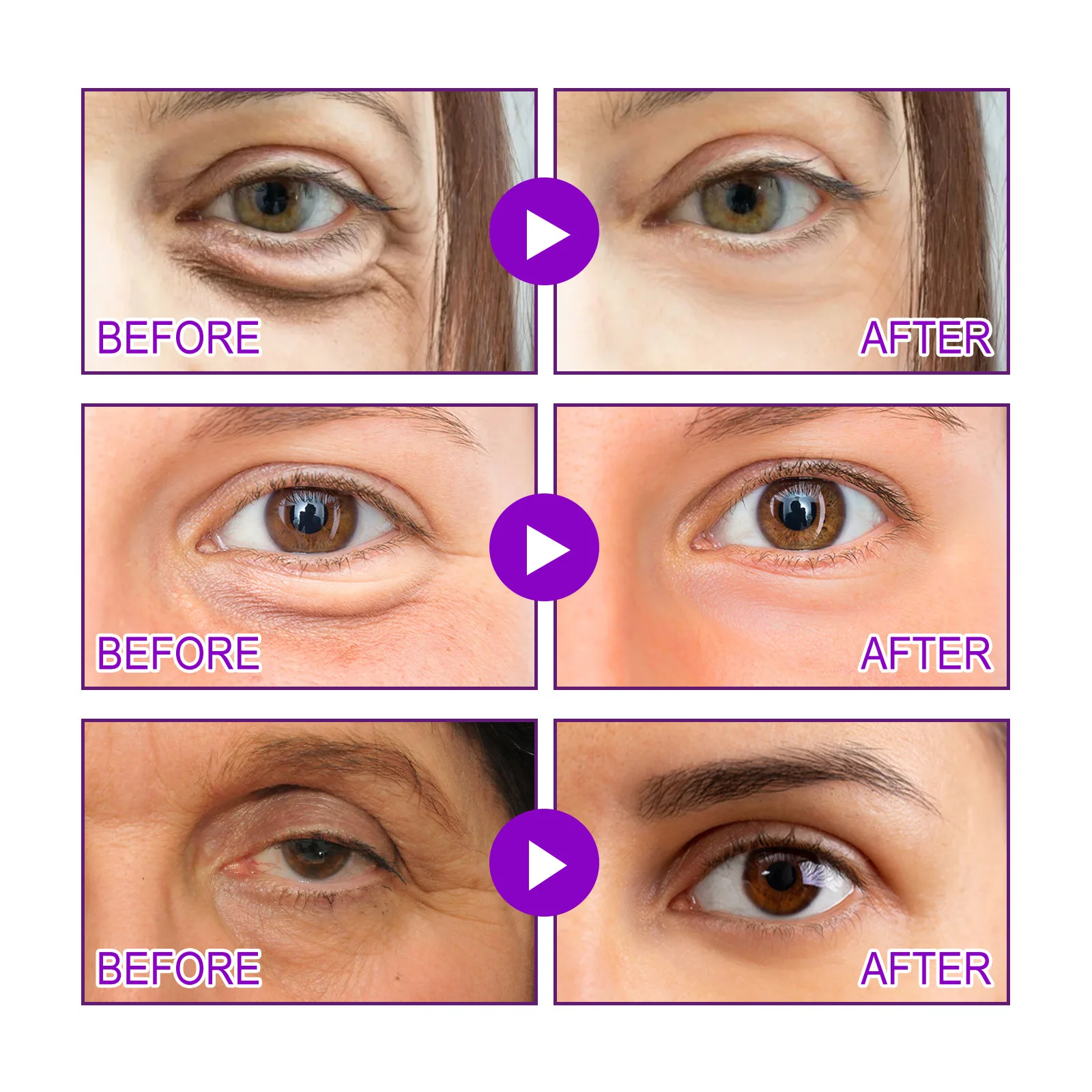 Рисунок 5 - Крем для области вокруг глаз