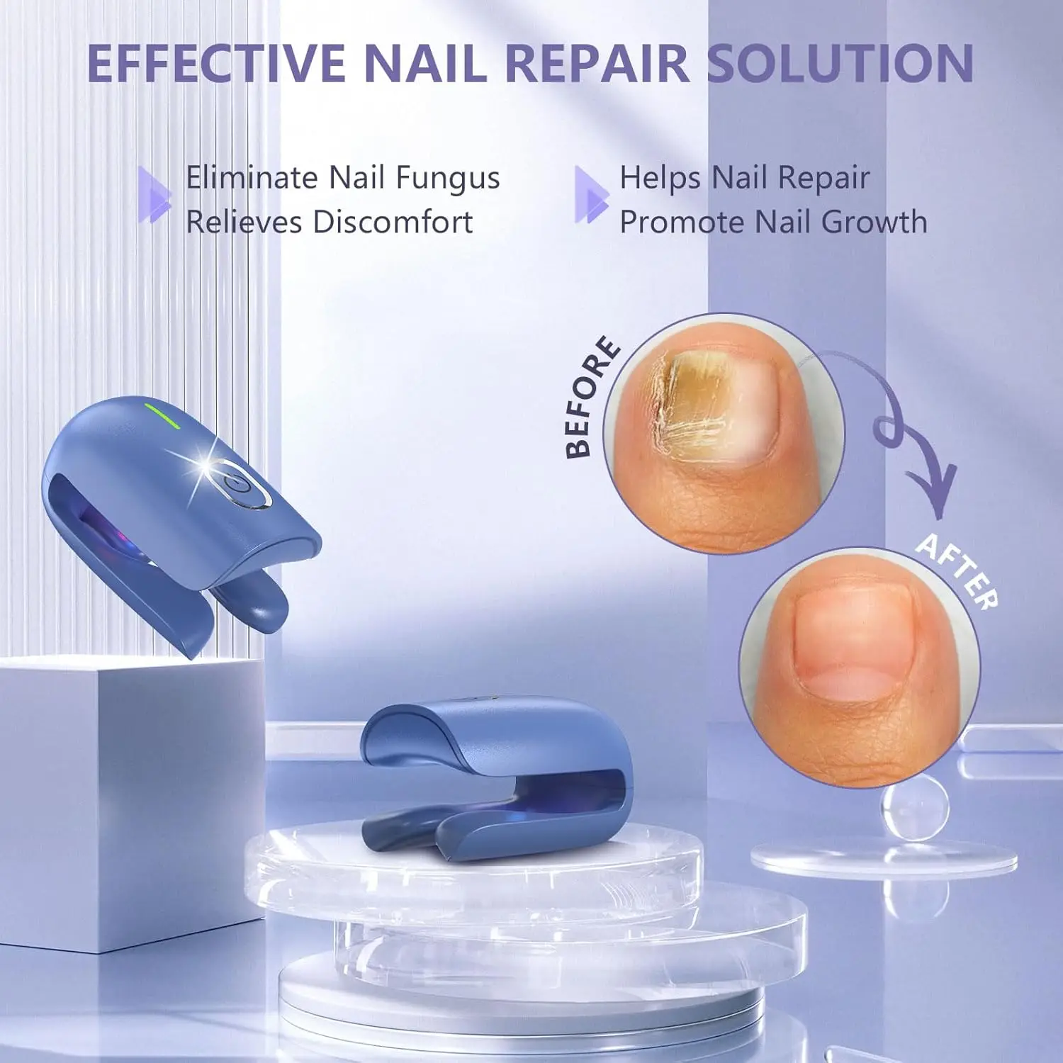 KTS Nail Fungus Laser Device 905nm 470nm USB Charge Toenail Laser Therapy Machine Nail Fungus Cleaning Device Discolored nail fungus remover laser therapy pen