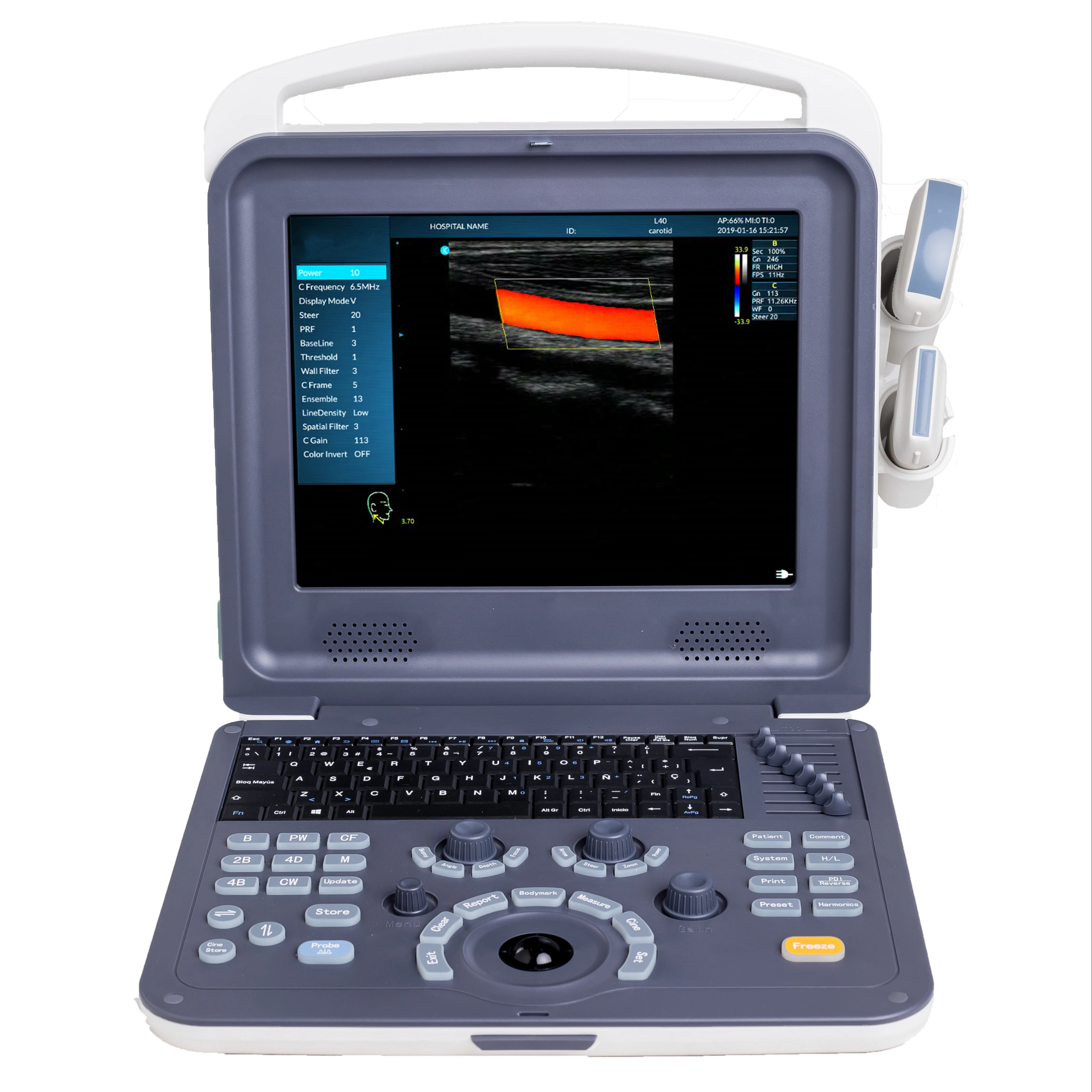 

Hot Selling 2D Medical Ultrasound Instruments Portable Color Doppler