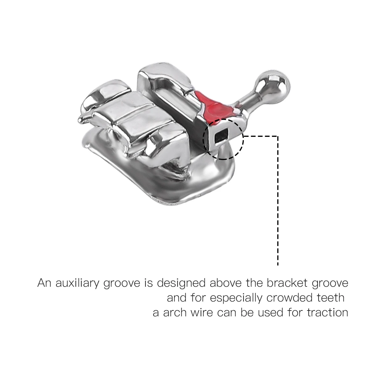orthodontic-self-ligating-brackets-buy-self-ligating-41-off