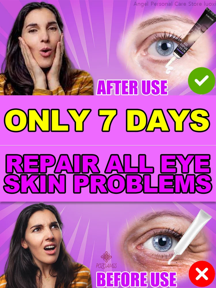 The most effective eye cream eliminates wrinkles eye bags dark circles tightens skin brightens skin in 7 days beauty enhancement product