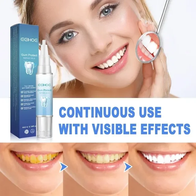 Tooth Repair Toothpaste Gel relief gum swelling pain cleaning yellow stains tartar removal odor Breath teeth Pen Oral Care 2