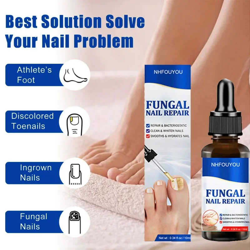 

Fungal Nail Treatment Oil Foot Repair Essence Toe Nail Fungus Removal Gel Anti Infection Cream Fungal Nail Removal 10ML