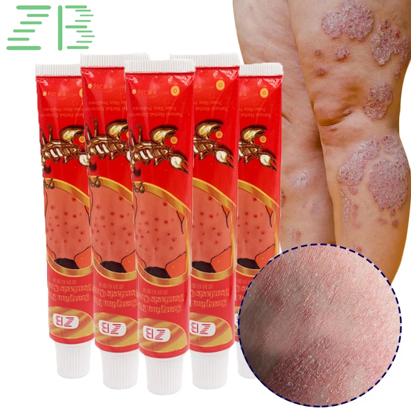 

5pcs Eczema Ointment Ringworm Beriberi Inhibit Fungi Anti-itch Treat Cream Cure Dermatitis Psoriasis Skin Repair Dressing 20g