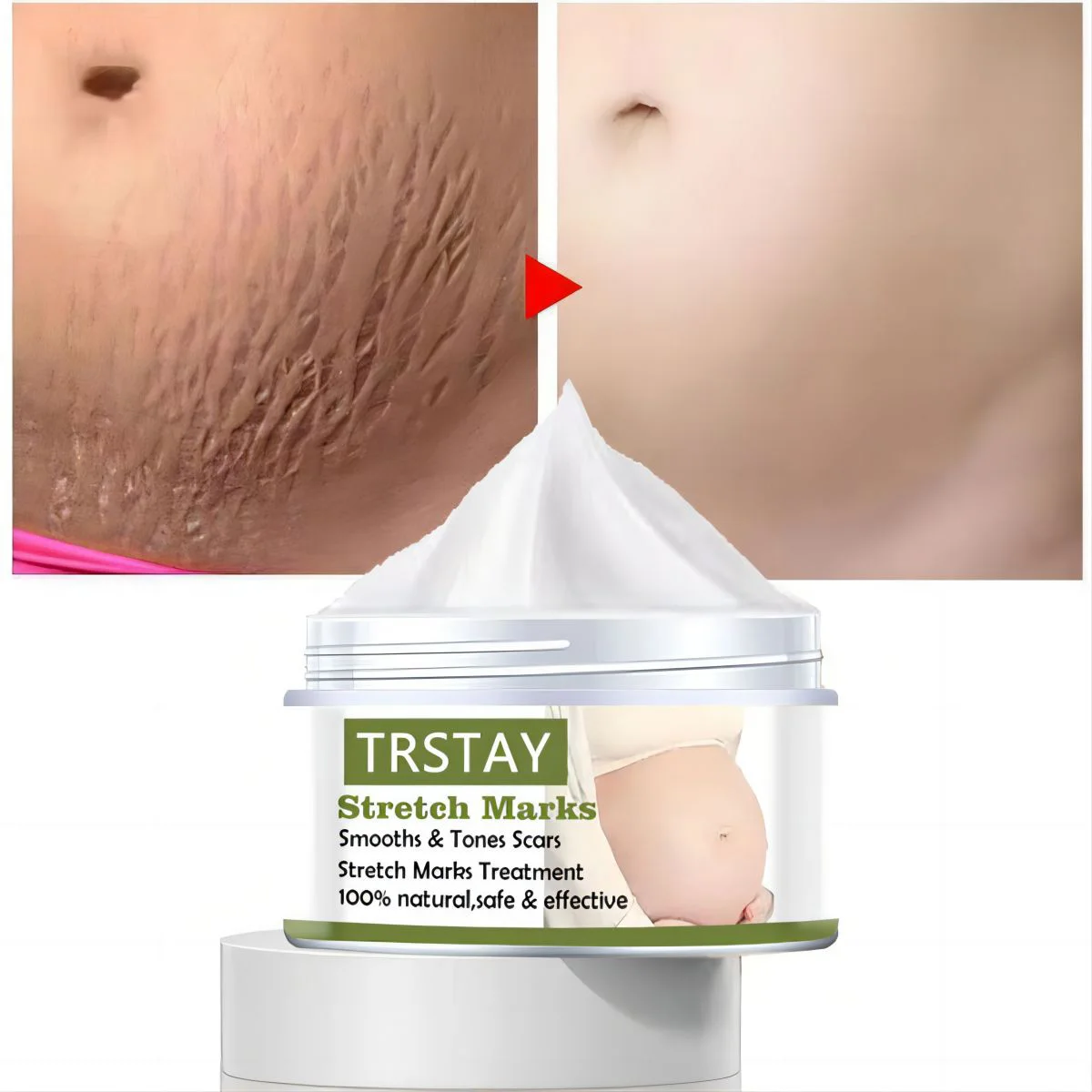 Pregnant Women's Belly Line Cream For Preventing Postpartum Pregnancy Lines Repair Cream 4