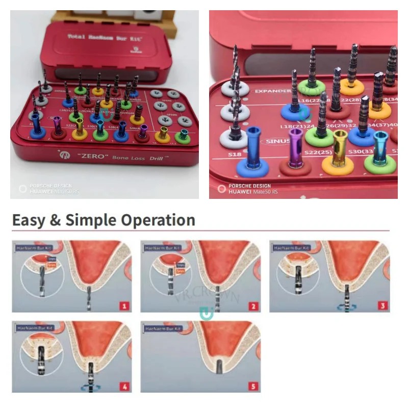 Набор инструментов для имплантации всего HaeNaem Sinus