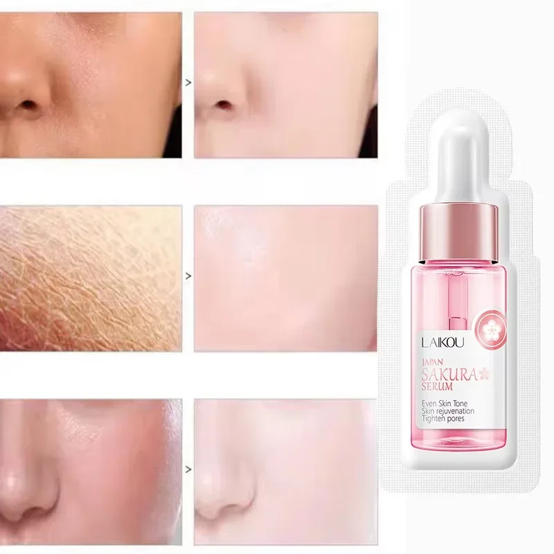 Sakura – sérum blanchissant pour le visage, Anti-âge, estompe les ridules, resserre les Pores, améliore le Pigment de mélanine, hydratant terne, éclaircissant, soins pour la peau – Image 2