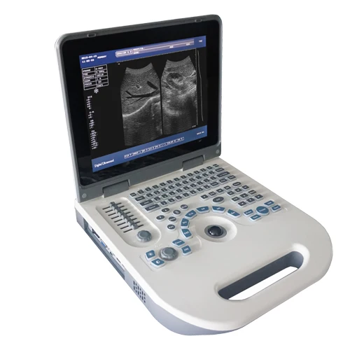 

Manufacture XF50 Full Digital LED Portable Prices of Ultrasound Scanner Machine