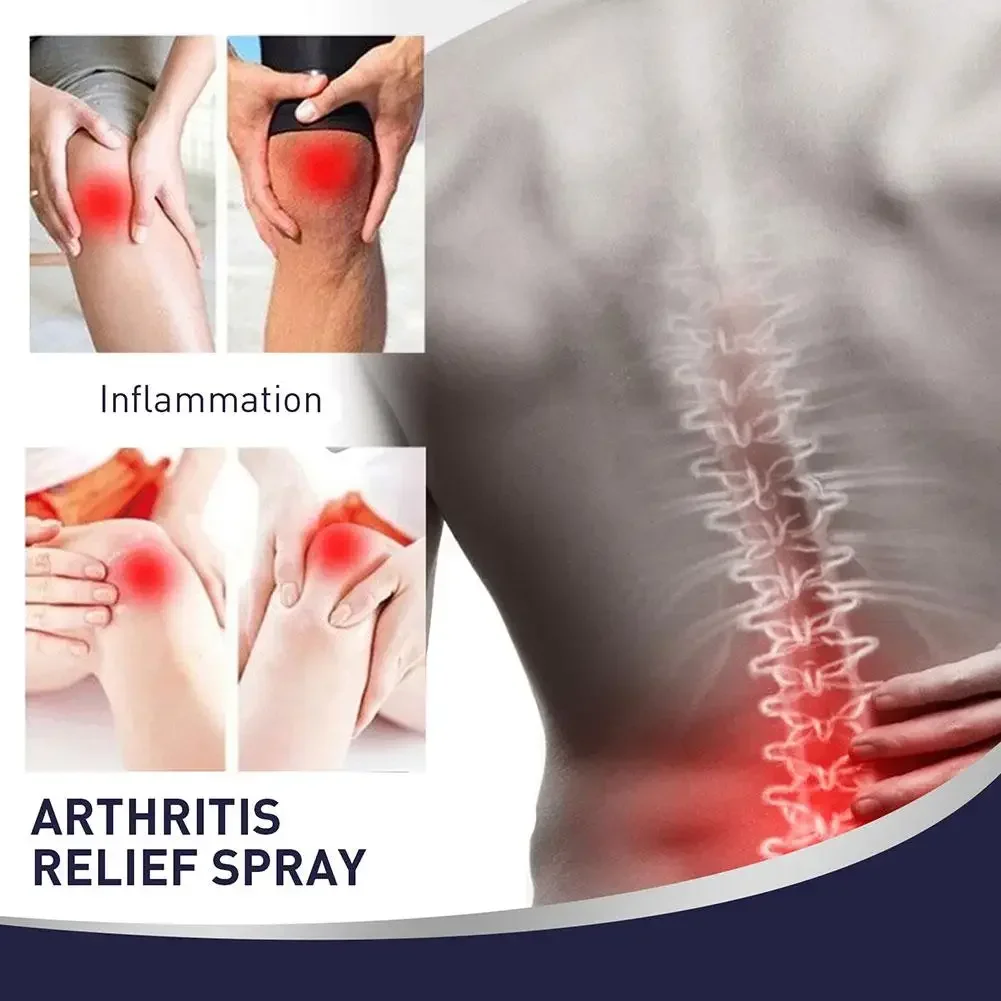 Joint Muscle Bone Spray Relieve Knee Lumbar Spine Ache Sprain Care Leg Arthritis Pain Rheumatoid Spary Tratamiento De Relajaci&oacute;n