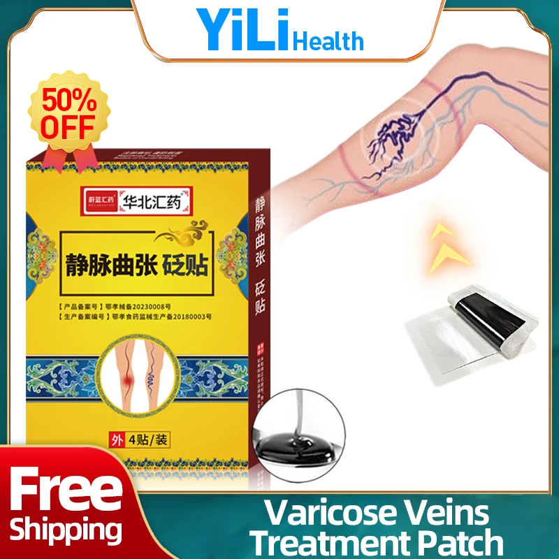 

Varicose Veins Varicocele Vein Treatment Patch Vasculitis Phlebitis Spider Legs Removal Vulvar Varicosity Repair Medicine