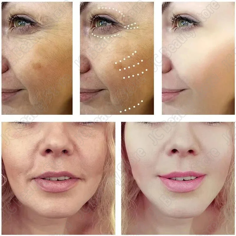 Freckle Whitening Serum Black Dots Melasma Remover Anti Brown Stain Lighten Pigmentation Moisturizing Skin Care Korean Products 4