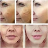 Freckle Whitening Serum Black Dots Melasma Remover Anti Brown Stain Lighten Pigmentation Moisturizing Skin Care Korean Products 4